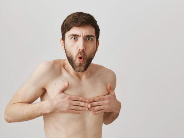 gynecomastia-surgery-in-delhi-ncr