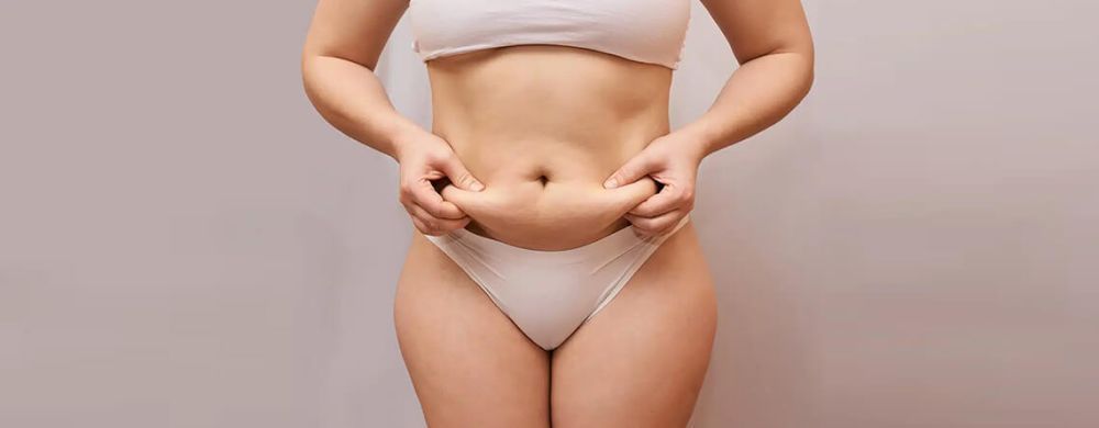 liposuction-care-after-surgery-recovery-aftercare-guide-big-0
