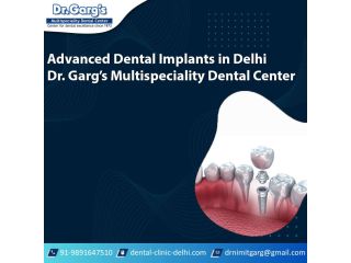 advanced-dental-implants-in-delhi-dr-gargs-multispeciality-dental-center-small-0