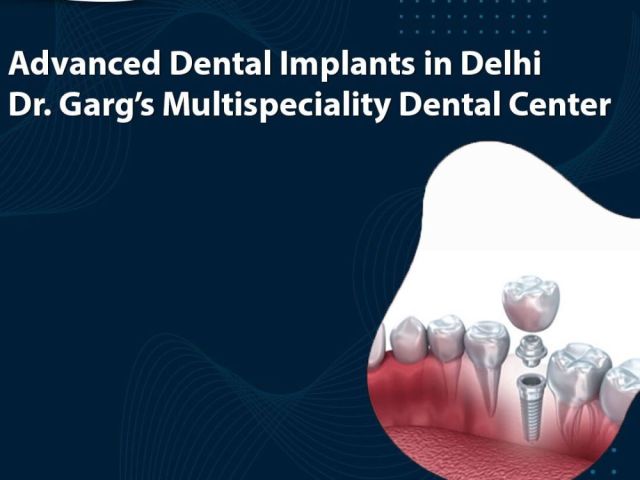 advanced-dental-implants-in-delhi-dr-gargs-multispeciality-dental-center