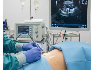 radiofrequency-ablation-treatment-rfa-cost-in-india-picture-this-small-0