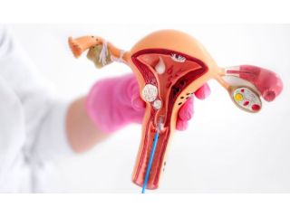 hysteroscopy-polypectomy-for-infertility-in-bareillymanasi-ivf-small-0