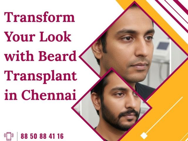 best-advvanced-hair-transplant-clinic-in-chennai