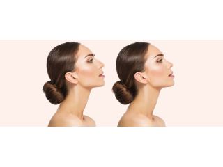 how-long-does-a-nose-job-take-to-heal-small-0