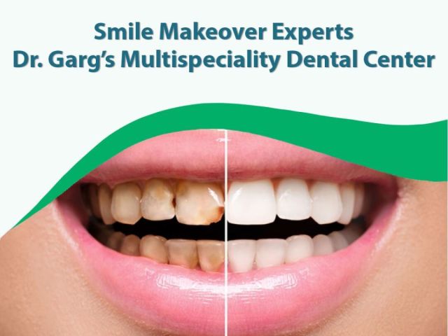 smile-makeover-experts-dr-gargs-multispeciality-dental-center