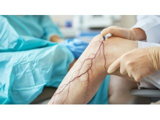 trusted-vascular-surgeon-in-gandhinagar-small-0