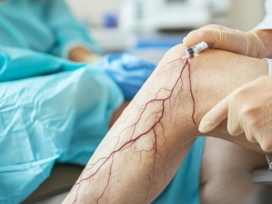 trusted-vascular-surgeon-in-gandhinagar