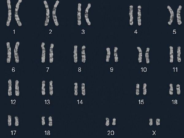 advanced-karyotyping-software-for-genetic-disorder-analysis