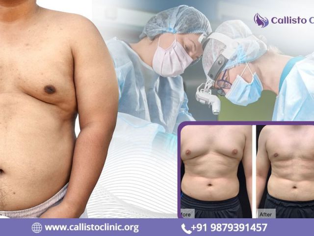 expert-gynecomastia-surgeon-in-surat-callisto-clinic