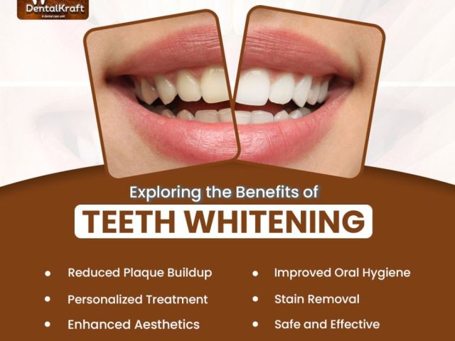 teeth-whitening-treatment-in-indirapuram-for-brighter-smiles