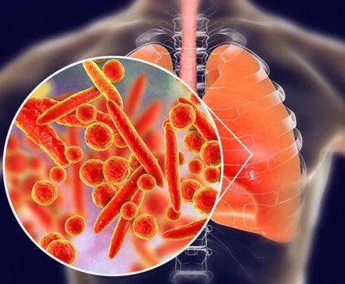 top-lung-specialist-in-jaipur-for-treatment-dr-sheetu-singh-big-0