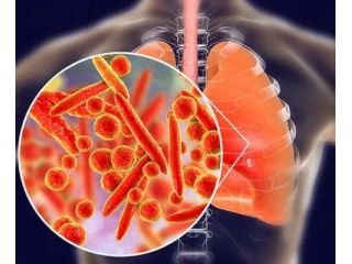 top-lung-specialist-in-jaipur-for-treatment-dr-sheetu-singh-small-0