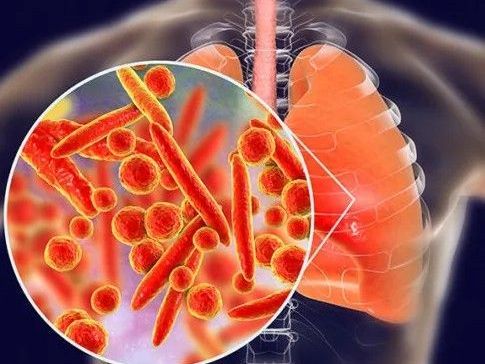 top-lung-specialist-in-jaipur-for-treatment-dr-sheetu-singh