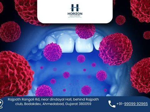 best-oral-cancer-surgeon-in-ahmedabad-dr-bhavin-vadodariya