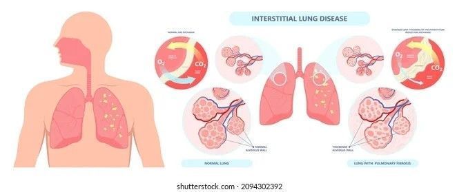 top-bronchoscopy-specialist-in-jaipur-asthma-bhawan-big-0