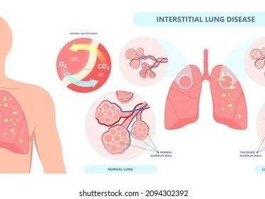 top-bronchoscopy-specialist-in-jaipur-asthma-bhawan