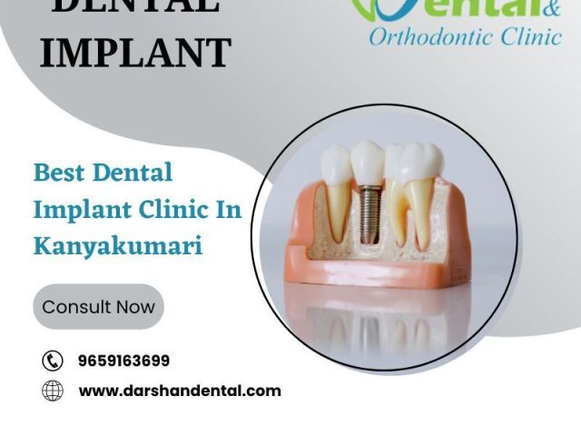dental-implant-clinic-in-kanyakumari-dental-clinic-kanyakumari