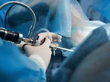 advanced-therapeutic-endoscopy-expert-in-punjab