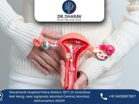 uterine-fibroids-treatment-doctor-in-india-dr-dharav-kheradia