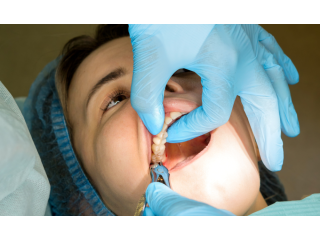 surgical-tooth-extraction-in-sector-12-noida-small-1