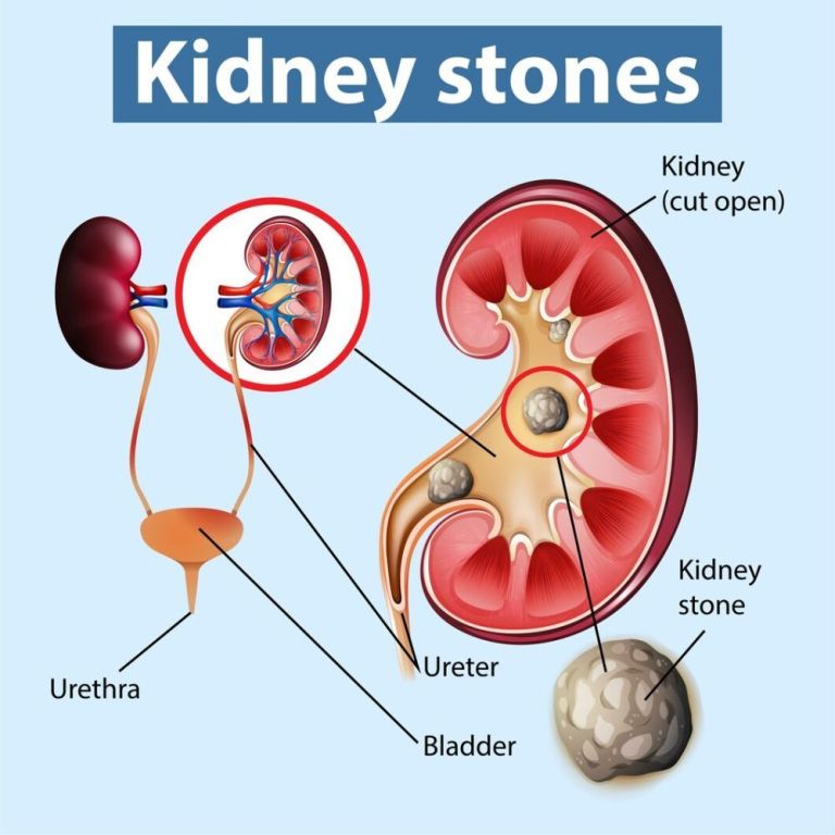 best-ayurvedic-hospital-in-gurgaon-big-0