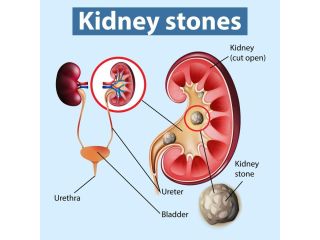 best-ayurvedic-hospital-in-gurgaon-small-0