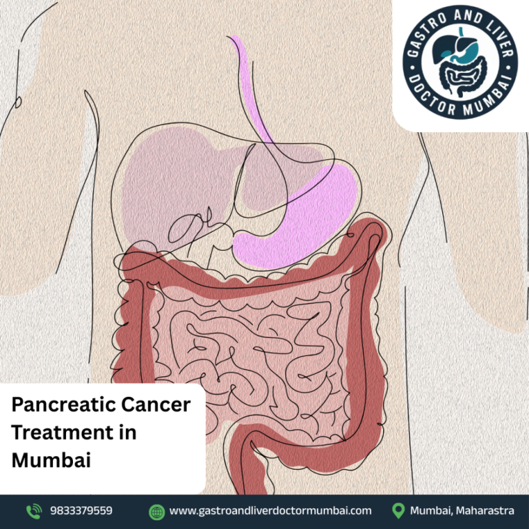 expert-pancreatic-cancer-treatment-in-mumbai-for-all-stages-big-0