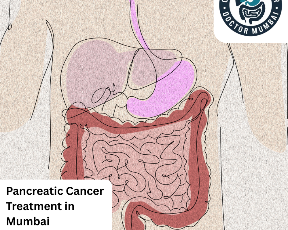 expert-pancreatic-cancer-treatment-in-mumbai-for-all-stages