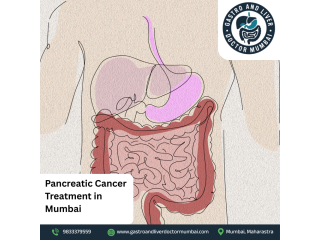 expert-pancreatic-cancer-treatment-in-mumbai-for-all-stages-small-0