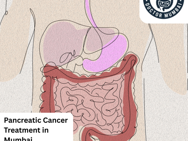 expert-pancreatic-cancer-treatment-in-mumbai-for-all-stages