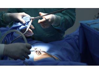 advanced-laparoscopy-operation-for-infertility-treatment-care-small-0