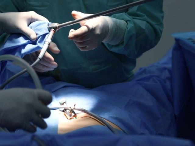 advanced-laparoscopy-operation-for-infertility-treatment-care