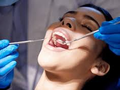 philips-zoom-for-teeth-brightening