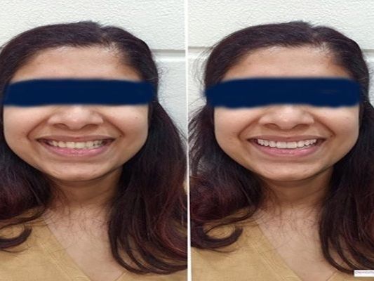why-do-patients-prefer-the-best-dental-clinic-in-parel