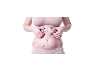 can-i-get-multiple-areas-of-liposuction-at-once-small-0