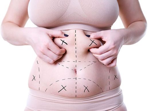 can-i-get-multiple-areas-of-liposuction-at-once