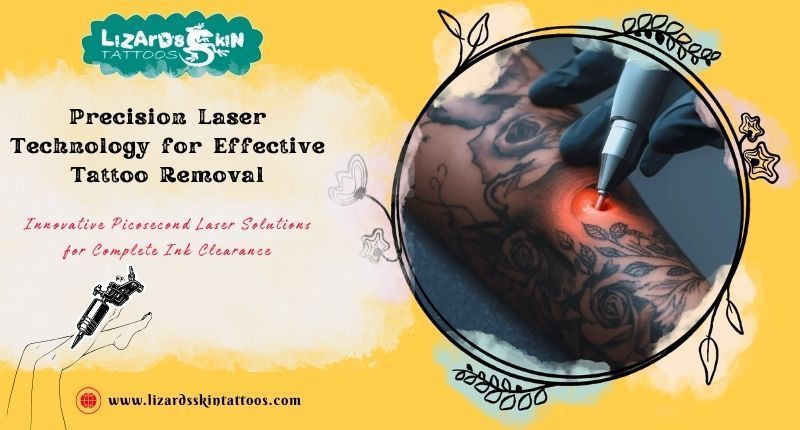 is-tattoo-removal-painful-new-tech-in-kolkata-clinics-big-0