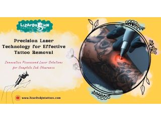 is-tattoo-removal-painful-new-tech-in-kolkata-clinics-small-0