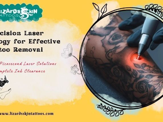 is-tattoo-removal-painful-new-tech-in-kolkata-clinics