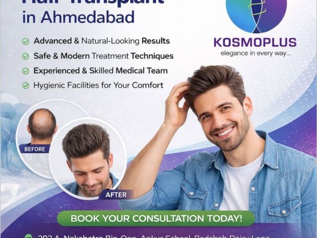 expert-hair-transplant-treatment-in-ahmedabad
