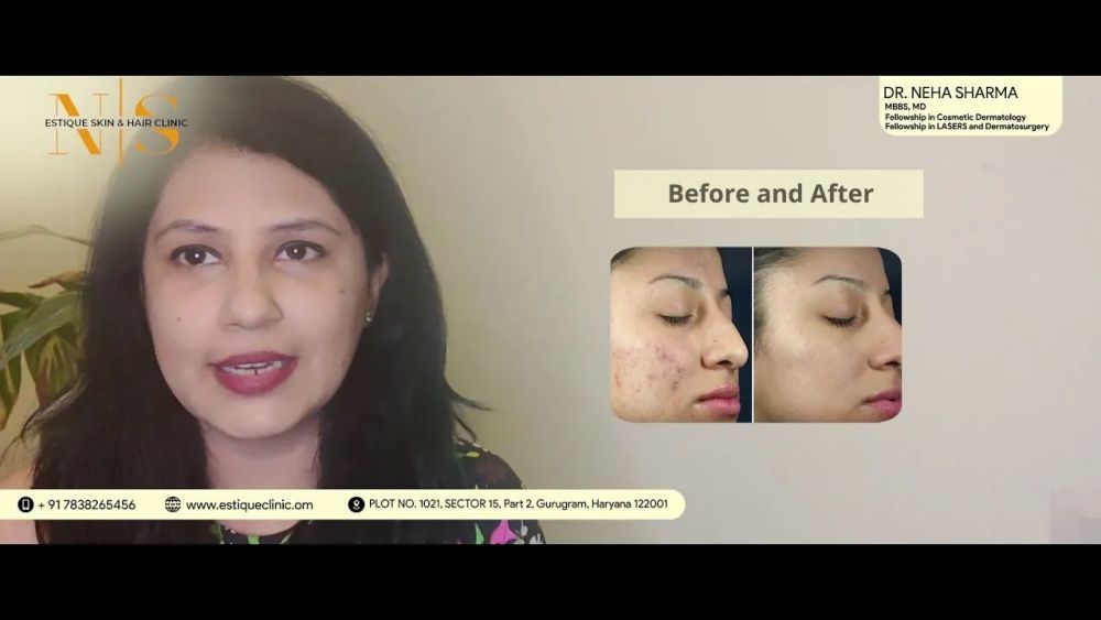 best-skin-specialist-in-gurgaon-big-0