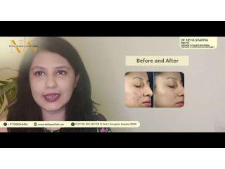 best-skin-specialist-in-gurgaon-small-0
