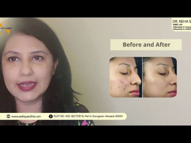 best-skin-specialist-in-gurgaon