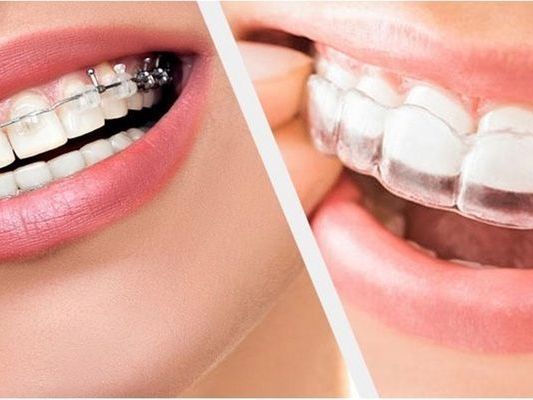 how-to-find-the-best-dental-clinic-in-dahisar-east