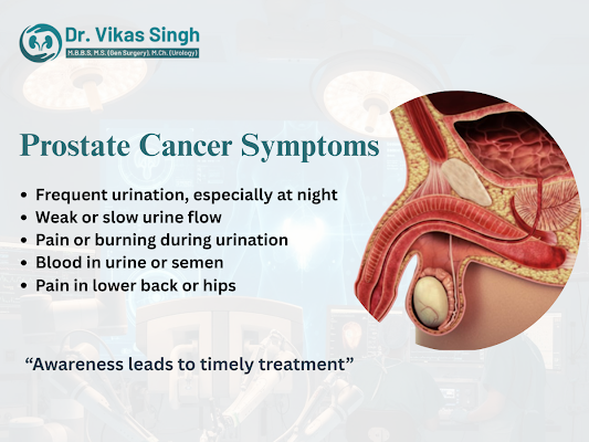 prostate-problems-treatment-in-indore-expert-urologist