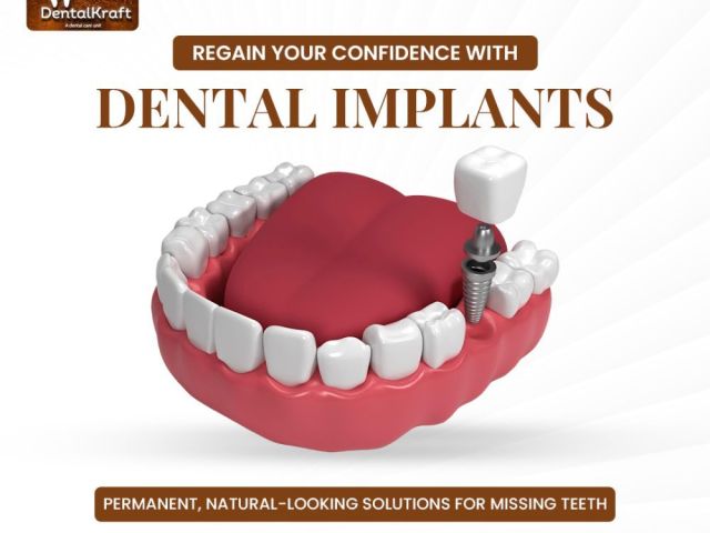 skilled-dental-implant-doctor-in-indirapuram-for-strong-teeth