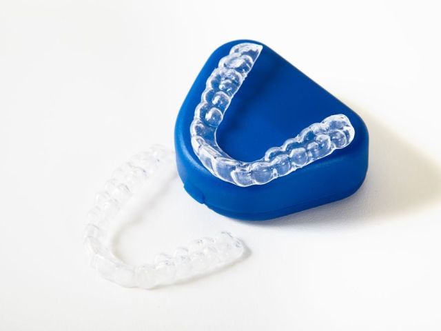 common-dental-problems-aligners-can-fix