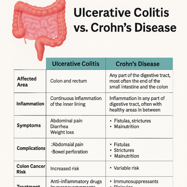 crohns-disease-vs-ulcerative-colitis-spotting-the-difference-big-0