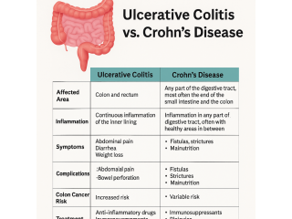 crohns-disease-vs-ulcerative-colitis-spotting-the-difference-small-0