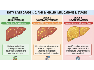 fatty-liver-warning-signs-causes-and-natural-healing-tips-small-0